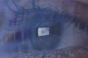 [Translate to Englisch:] Brille,in der sich etwas spiegelt