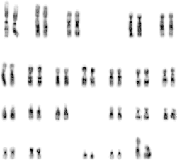 Human chromosome (karyogram)
