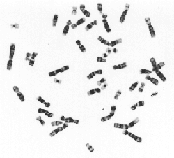 Menschliche Chromosomen ungeordnet